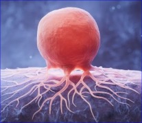 Carisma Therapeutics’ solid tumour therapy obtains FDA Fast Track status