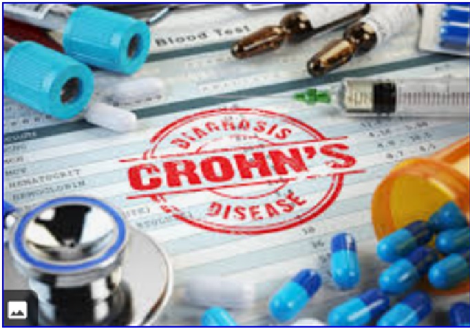 FDA-approved drug for ulcerative colitis also effective for Crohn's