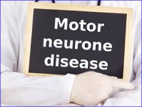 Researchers develop new approach to target cells affected by motor neurone disease