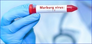 FDA Grants Soligenix Orphan Drug Designation for the Prevention and Post-Exposure Prophylaxis Against Marburg Marburgvirus Infection