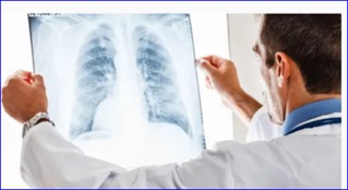 Krazati slows disease progression in certain patients with lung cancer