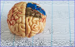 New AI Algorithm Detects Rare Epileptic Seizures from EEG Data