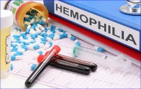 FDA Approves Marstacimab-hncq for Adults, Adolescents With Hemophilia A or B Without Inhibitors