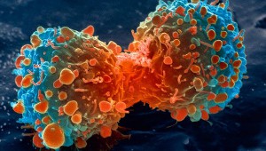 lung-cancer-cell-dividing-article.__v400248237